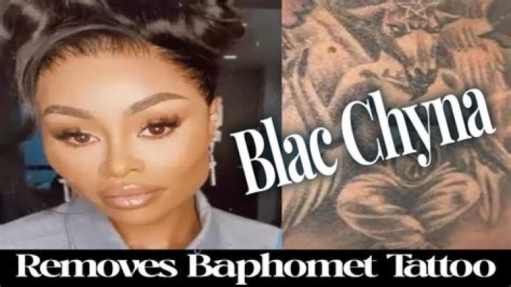 Blac Chyna removes Baphomet tattoo Blac Chyna removes Baphomet tattoo