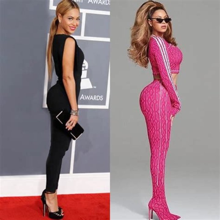 Did Beyonce Have A BBL