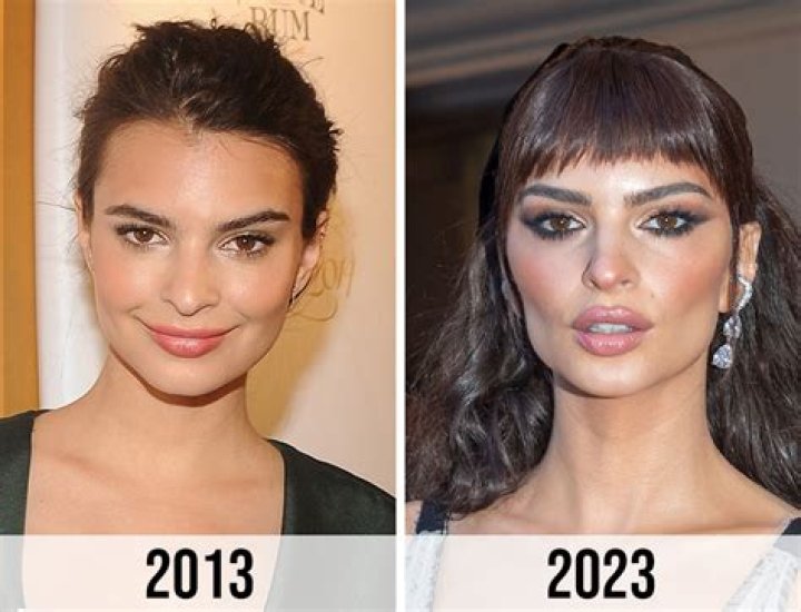 Did Emily Ratajkowski Have Breast Augmentation? Boob Job And Surgery Update Emily Ratajkowski Breast Augmentation