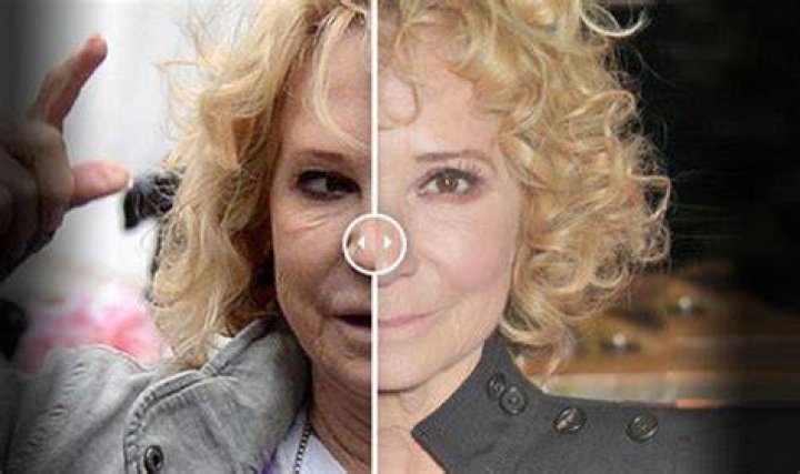 Felicity Kendal surgery