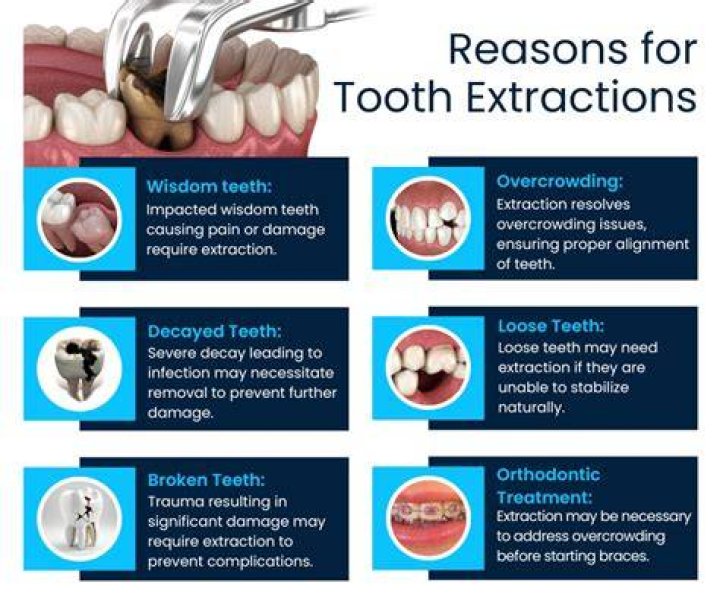 risks of tooth extraction risks of tooth extraction