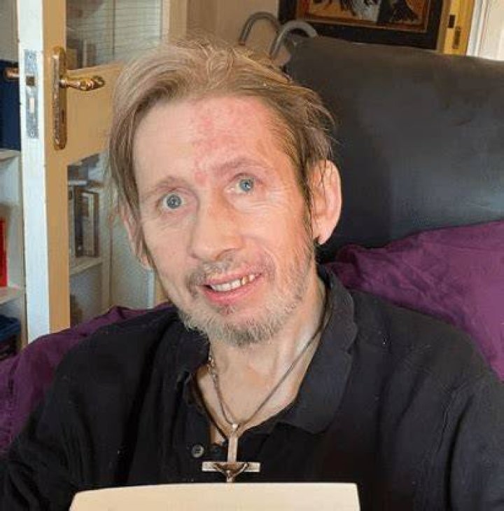Shane Macgowan Weight Loss